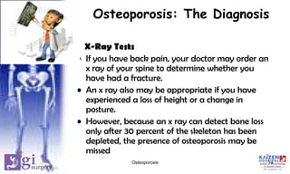 Osteoporosis: The Diagnosis
X-Ray Tests
• If you have back pain, your doctor may order an
x ray of your spine to determine whether you
have had a fracture.
• An x ray also may be appropriate if you have
experienced a loss of height or a change in
posture.
• However, because an x ray can detect bone loss
only after 30 percent of the skeleton has been
depleted, the presence of osteoporosis may be
missed
14Osteoporosis
 