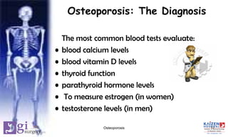 Osteoporosis: The Diagnosis
The most common blood tests evaluate:
• blood calcium levels
• blood vitamin D levels
• thyroid function
• parathyroid hormone levels
• To measure estrogen (in women)
• testosterone levels (in men)
17Osteoporosis
 