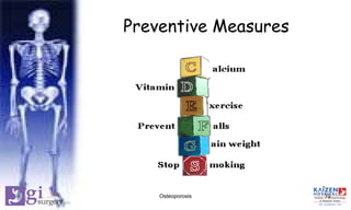 Preventive Measures
19Osteoporosis
 