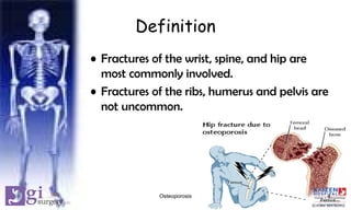 Definition
• Fractures of the wrist, spine, and hip are
most commonly involved.
• Fractures of the ribs, humerus and pelvis are
not uncommon.
4Osteoporosis
 