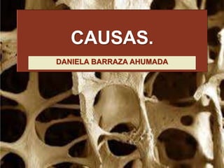 CAUSAS.
DANIELA BARRAZA AHUMADA
 