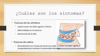 ¿Cuáles son los síntomas?
• fracturas de las vértebras
• suelen cursar con dolor agudo o crónico
• deformidades en la columna
• disminución de la talla
• fracturas de cadera
• Generalmente son consecuencia de una caída, y cursan con dolor agudo e
incapacidad para movilizar la extremidad afectada.
 