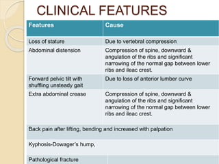 CLINICAL FEATURES
Features Cause
Loss of stature Due to vertebral compression
Abdominal distension Compression of spine, downward &
angulation of the ribs and significant
narrowing of the normal gap between lower
ribs and ileac crest.
Forward pelvic tilt with
shuffling unsteady gait
Due to loss of anterior lumber curve
Extra abdominal crease Compression of spine, downward &
angulation of the ribs and significant
narrowing of the normal gap between lower
ribs and ileac crest.
Back pain after lifting, bending and increased with palpation
Kyphosis-Dowager’s hump,
Pathological fracture
 