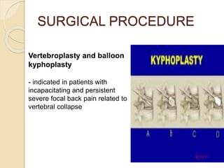 SURGICAL PROCEDURE
Vertebroplasty and balloon
kyphoplasty
- indicated in patients with
incapacitating and persistent
severe focal back pain related to
vertebral collapse
 