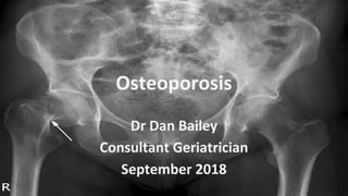 Osteoporosis
Dr Dan Bailey
Consultant Geriatrician
September 2018
 