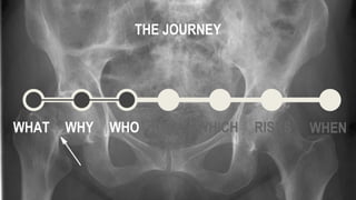 WHAT WHY WHO HOW WHICH WHEN
THE JOURNEY
RISKS
 