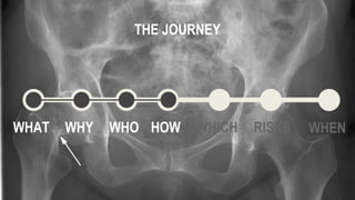 WHAT WHY WHO HOW WHICH WHEN
THE JOURNEY
RISKS
 