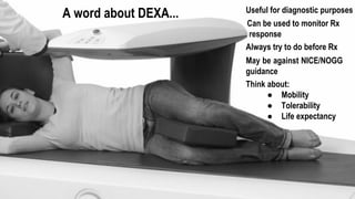 A word about DEXA...
Can be used to monitor Rx
response
Useful for diagnostic purposes
Always try to do before Rx
May be against NICE/NOGG
guidance
Think about:
● Mobility
● Tolerability
● Life expectancy
 