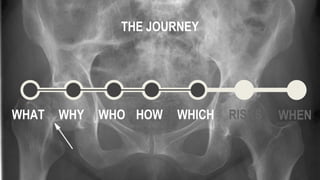 WHAT WHY WHO HOW WHICH WHEN
THE JOURNEY
RISKS
 