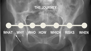WHAT WHY WHO HOW WHICH WHEN
THE JOURNEY
RISKS
 