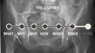 WHAT WHY WHO HOW WHICH WHEN
THE JOURNEY
RISKS
 