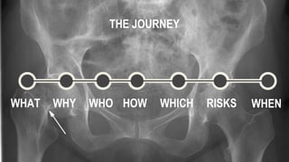 WHAT WHY WHO HOW WHICH WHEN
THE JOURNEY
RISKS
 