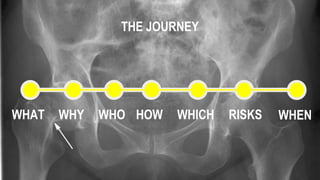 WHAT WHY WHO HOW WHICH WHEN
THE JOURNEY
RISKS
 