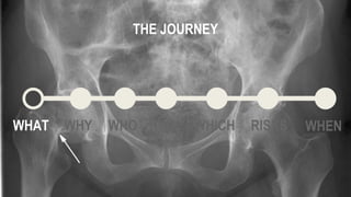 WHAT WHY WHO HOW WHICH WHEN
THE JOURNEY
RISKS
 