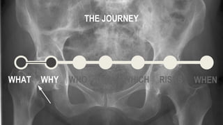WHAT WHY WHO HOW WHICH WHEN
THE JOURNEY
RISKS
 