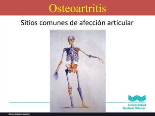 Sitios comunes de afección articular
Osteoartritis
 