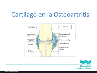 Cartílago en la Osteoartritis
 