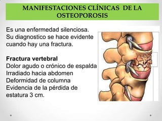 MANIFESTACIONES CLÍNICAS DE LA
             OSTEOPOROSIS

Es una enfermedad silenciosa.
Su diagnostico se hace evidente
cuando hay una fractura.

Fractura vertebral
Dolor agudo o crónico de espalda
Irradiado hacia abdomen
Deformidad de columna
Evidencia de la pérdida de
estatura 3 cm.
 