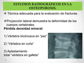 ESTUDIOS RADIOGRÁFICOS EN LA
              OSTEOPOROSIS.
 Técnica adecuada para la evaluación de fracturas.

Proyección lateral demuestra la deformidad de los
 cuerpos vertebrales.
Pérdida densidad mineral:

1) Vértebra bicóncava en “pez”

2) “Vértebra en cuña”

3) Aplastamiento
total “vértebra en galleta”
 