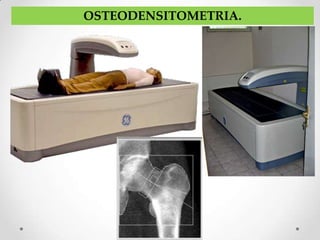 OSTEODENSITOMETRIA.
 