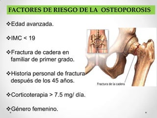 FACTORES DE RIESGO DE LA OSTEOPOROSIS

Edad avanzada.

IMC < 19

Fractura de cadera en
 familiar de primer grado.

Historia personal de fractura
 después de los 45 años.

Corticoterapia > 7.5 mg/ día.

Género femenino.
 