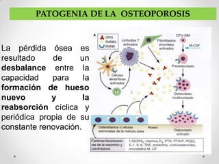 PATOGENIA DE LA OSTEOPOROSIS



La pérdida ósea es
resultado    de     un
desbalance entre la
capacidad    para     la
formación de hueso
nuevo        y        la
reabsorción cíclica y
periódica propia de su
constante renovación.
 