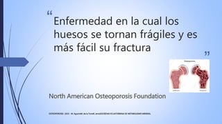 “
”
Enfermedad en la cual los
huesos se tornan frágiles y es
más fácil su fractura
North American Osteoporosis Foundation
...