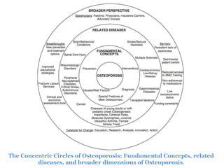 The Concentric Circles of Osteoporosis: Fundamental Concepts, related
diseases, and broader dimensions of Osteoporosis.
 