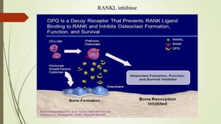 RANKL inhibitor
 