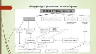 Pathophysiology of glucocorticoids- induced osteoporosis
 