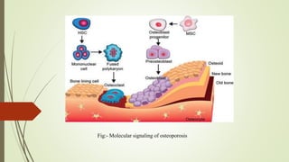 Fig:- Molecular signaling of osteoporosis
 