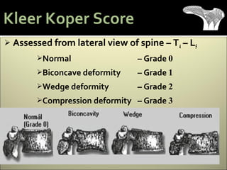  Assessed from lateral view of spine – T4 – L5
Normal – Grade 0
Biconcave deformity – Grade 1
Wedge deformity – Grade 2
Compression deformity – Grade 3
Kleer Koper Score
 