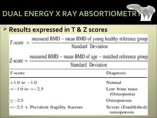  Results expressed in T & Z scores
DUAL ENERGY X RAY ABSORTIOMETRY
 