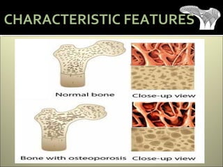 CHARACTERISTIC FEATURES
 