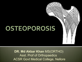 OSTEOPOROSIS
DR. Md Akbar Khan MS(ORTHO)
Asst. Prof of Orthopaedics
ACSR Govt Medical College, Nellore
 