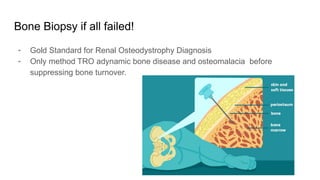 Osteoporosis Disease in Chronic Kidney Diseases | PPTX