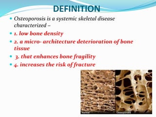 DEFINITION
 Osteoporosis is a systemic skeletal disease
characterized –
 1. low bone density
 2. a micro- architecture deterioration of bone
tissue
 3. that enhances bone fragility
 4. increases the risk of fracture
 