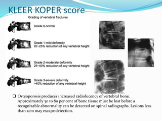 KLEER KOPER score
 Osteoporosis produces increased radiolucency of vertebral bone.
Approximately 30 to 80 per cent of bone tissue must be lost before a
recognizable abnormality can be detected on spinal radiographs. Lesions less
than 2cm may escape detection.
 