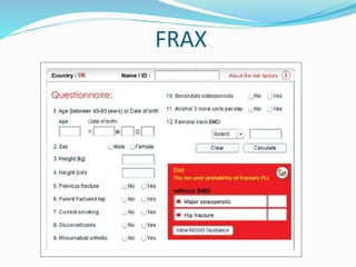 FRAX
 