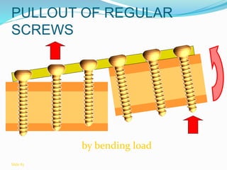 by bending load
PULLOUT OF REGULAR
SCREWS
Slide 83
 