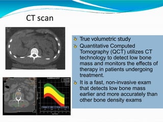 CT scan
True volumetric study
Quantitative Computed
Tomography (QCT) utilizes CT
technology to detect low bone
mass and monitors the effects of
therapy in patients undergoing
treatment.
It is a fast, non-invasive exam
that detects low bone mass
earlier and more accurately than
other bone density exams
 
