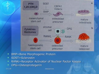 14.1.0514.1.05 OsteoporosisOsteoporosis 1111
 BMP=Bone Morphogenic ProteinBMP=Bone Morphogenic Protein
 SOST=SclerostinSOST=Sclerostin
 RANK=Receptor Activator of Nuclear Factor KappaRANK=Receptor Activator of Nuclear Factor Kappa
 OPG=OsteoprotegerinOPG=Osteoprotegerin
 