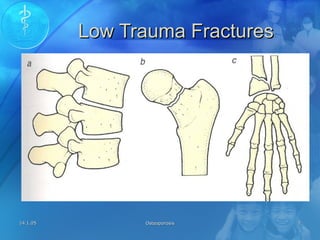 14.1.0514.1.05 OsteoporosisOsteoporosis 77
Low Trauma FracturesLow Trauma Fractures
 