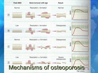 14.1.0514.1.05 OsteoporosisOsteoporosis 99
Mechanisms of osteoporosisMechanisms of osteoporosis
 
