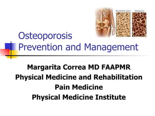 Osteoporosis Prevention and Management Margarita Correa MD FAAPMR Physical Medicine and Rehabilitation Pain Medicine Physical Medicine Institute 