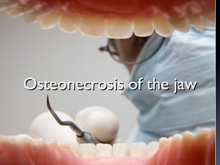 Osteonecrosis of the jaw
 