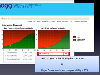 Osteoporosis talk july 2012 4 slideshare