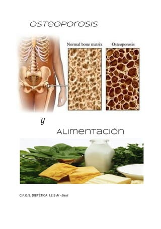 Osteoporosis  
 ​Y
    ​Alimentación
 
 
 
C.F.G.S. DIETÉTICA  I.E.S ​Al ­ Basit  
 
 
 