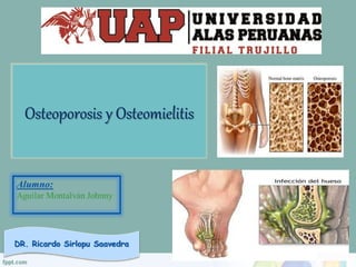 DR. Ricardo Sirlopu Saavedra
Osteoporosis y Osteomielitis
 