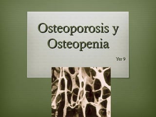 Osteoporosis yOsteoporosis y
OsteopeniaOsteopenia
Yer 9Yer 9
 